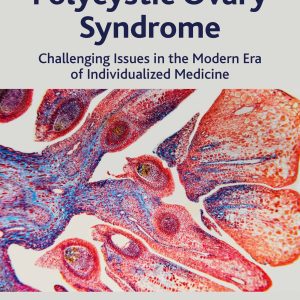Polycystic Ovary Syndrome: Challenging Issues in the Modern Era of Individualized Medicine (EPUB)