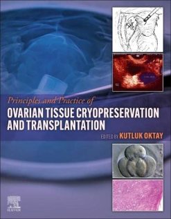 Principles and Practice of Ovarian Tissue Cryopreservation and Transplantation (Original PDF from Publisher)