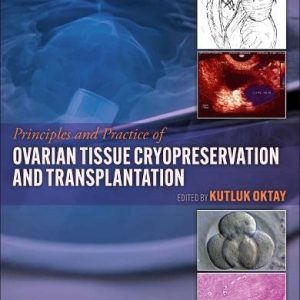 Principles and Practice of Ovarian Tissue Cryopreservation and Transplantation (Original PDF from Publisher)