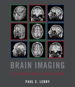 Brain Imaging: A Guide for Clinicians