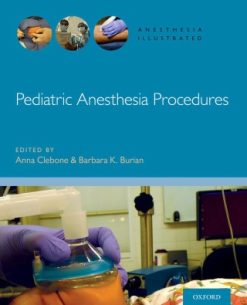 Pediatric Anesthesia Procedures (EPUB)