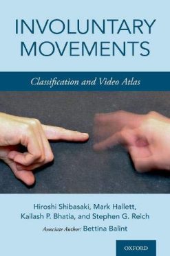 Involuntary Movements: Classification and Video Atlas (VIDEOS)