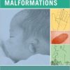 Common Malformations