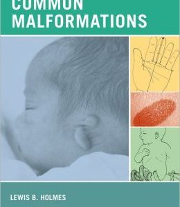 Common Malformations