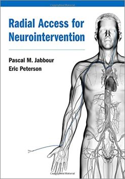Radial Access for Neurointervention (Videos)