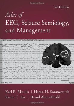 Atlas of EEG, Seizure Semiology, and Management, 3rd Edition (Original PDF from Publisher)