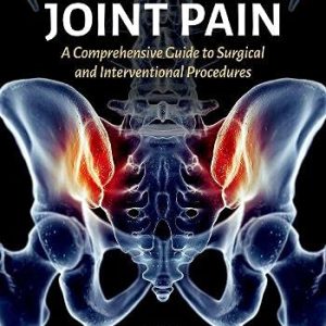 Sacroiliac Joint Pain: A Comprehensive Guide to Interventional and Surgical Procedures (Original PDF from Publisher)