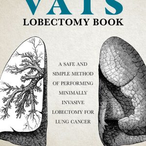 The VATS Lobectomy Book (Original PDF from Publisher)