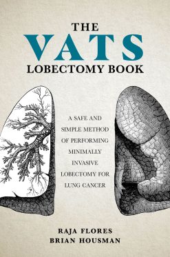 The VATS Lobectomy Book (EPUB)