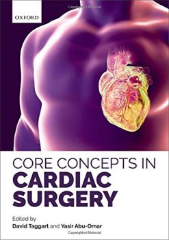 Core Concepts in Cardiac Surgery (PDF)