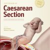 Textbook of Caesarean Section (PDF)