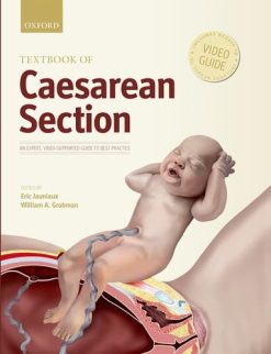 Textbook of Caesarean Section (PDF)