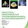 Practical Perioperative Transoesophageal Echocardiography (Oxford Clinical Imaging Guides), 3rd Edition (Original PDF from Publisher)