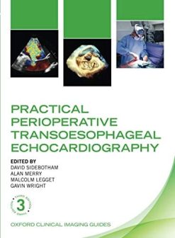 Practical Perioperative Transoesophageal Echocardiography (Oxford Clinical Imaging Guides), 3rd Edition (Original PDF from Publisher)