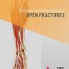 Standards for the Management of Open Fractures (Original PDF from Publisher)