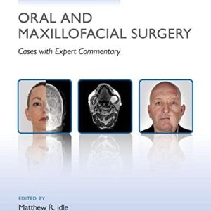 Challenging Concepts in Oral and Maxillofacial Surgery: Cases with Expert Commentary (PDF)