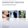 Challenging Concepts in Respiratory Medicine: Cases with Expert Commentary (Original PDF from Publisher)