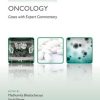 Challenging Concepts in Oncology (Original PDF from Publisher)