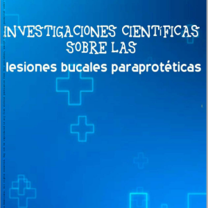 Investigaciones científicas sobre las lesiones bucales paraprotéticas (Original PDF from Publisher)