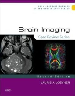 Brain Imaging: Case Review Series, 2nd Edition (ORIGINAL PDF from Publisher)