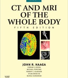CT and MRI of the Whole Body, 2-Volume Set, 5th Edition (ORIGINAL PDF from Publisher)