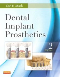 Dental Implant Prosthetics, 2nd Edition (Original PDF from Publisher)