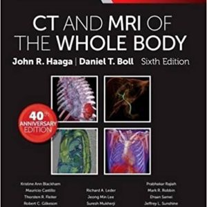 CT and MRI of the Whole Body, 2-Volume Set, 6th Edition (Original PDF from Publisher)