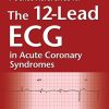 Pocket Reference for The 12-Lead ECG in Acute Coronary Syndromes, 3e (Original PDF from Publisher)