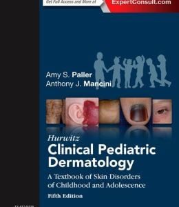 Hurwitz Clinical Pediatric Dermatology, 5th Edition (Original PDF from Publisher)