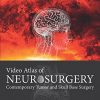 Video Atlas of Neurosurgery: Contemporary Tumor and Skull Base Surgery (ORIGINAL PDF from Publisher)