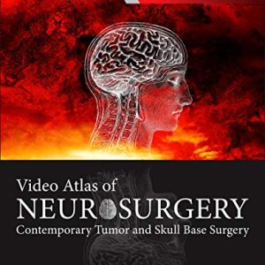 Video Atlas of Neurosurgery: Contemporary Tumor and Skull Base Surgery (Videos, Organized)
