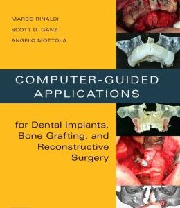 Computer-Guided Applications for Dental Implants, Bone Grafting, and Reconstructive Surgery