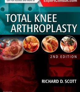 Total Knee Arthroplasty, 2nd Edition (ORIGINAL PDF from Publisher)