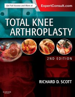 Total Knee Arthroplasty, 2nd Edition (ORIGINAL PDF from Publisher)