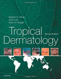 Tropical Dermatology, 2nd Edition (PDF)