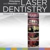 Principles and Practice of Laser Dentistry, 2nd Edition