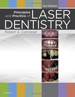 Principles and Practice of Laser Dentistry, 2nd Edition