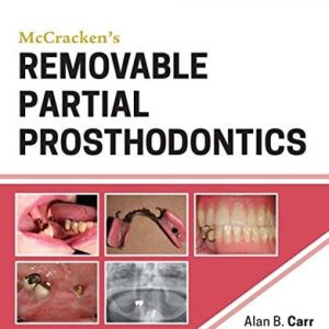McCracken’s Removable Partial Prosthodontics, 13th Edition