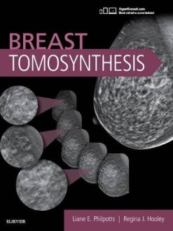 Breast Tomosynthesis (PDF)