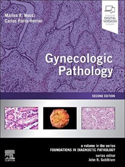 Gynecologic Pathology: A Volume in Foundations in Diagnostic Pathology Series, 2nd Edition (True PDF with ToC + Index)