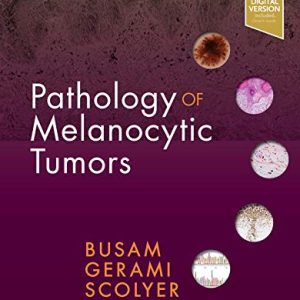 Pathology of Melanocytic Tumors (PDF)