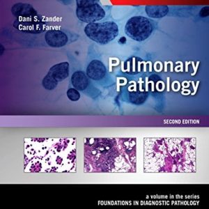 Pulmonary Pathology: A Volume in the Series: Foundations in Diagnostic Pathology, 2nd Edition (ORIGINAL PDF from Publisher)