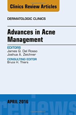 Advances in Acne Management, An Issue of Dermatologic Clinics, 1e (The Clinics: Dermatology) (PDF)