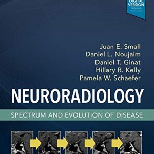 Neuroradiology: Spectrum and Evolution of Disease (Original PDF from Publisher)