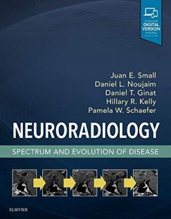 Neuroradiology: Spectrum and Evolution of Disease (ePUB)