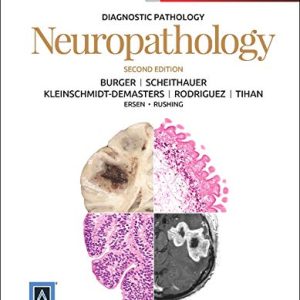 Diagnostic Pathology: Neuropathology, 2nd Edition (Original PDF from Publisher with High Quality Images)