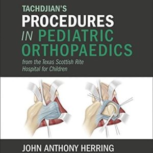 Tachdjian’s Procedures in Pediatric Orthopaedics: From the Texas Scottish Rite Hospital for Children (ORIGINAL PDF from Publisher)