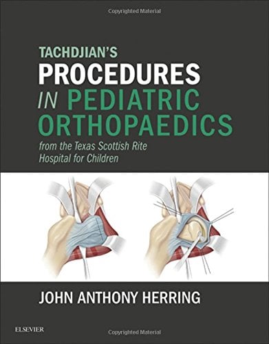 Tachdjian’s Procedures in Pediatric Orthopaedics: From the Texas Scottish Rite Hospital for Children (ORIGINAL PDF from Publisher)