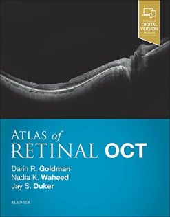 Atlas of Retinal OCT: Optical Coherence Tomography, 1e (PDF)