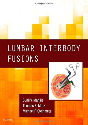 Lumbar Interbody Fusions (PDF)